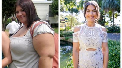 رفضت إجراء جراحات تجميل.. فتاة تخسر 65 كيلو من وزنها بطريقة مذهلة!