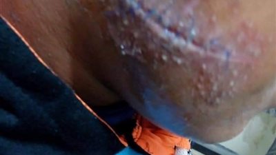 بعد قطعه وجه زميله.. إخلاء سبيل طالب بكرداسة