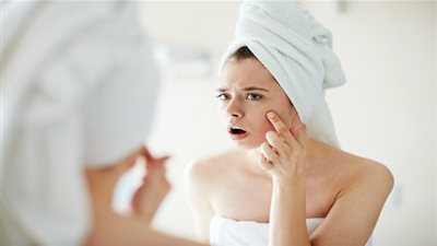 5 خلطات طبيعية لإزالة آثار حب الشباب المزعجة