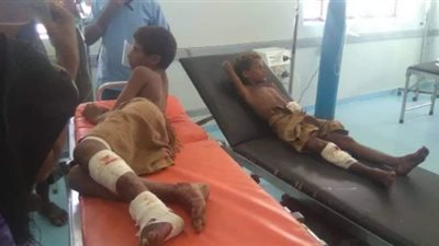 إصابة 3 أطفال يمنيين في انفجار لغم حوثي في الحديدة