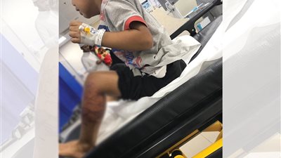 عاجل - السعودية| واقعة الطفل الملسوع في جازان تتفاعل.. الأب يتهم المستشفى والصحة تحمله المسؤولية