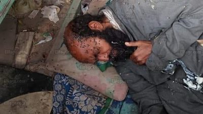 مدير مستشفى الخانكة يكشف حقيقة رفضه دخول مسن مُلقى بالشارع (فيديو)