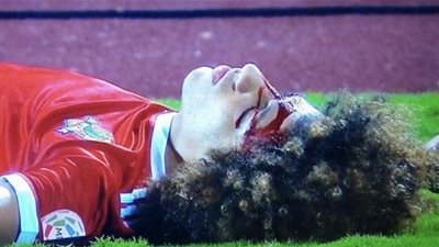 إصابة عنيفة لنجم الوحدة الإماراتي 