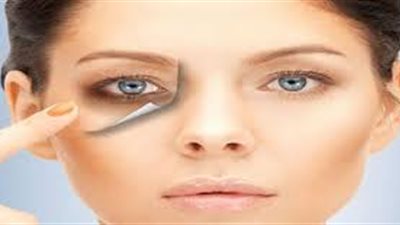 وصفة مجربة للقضاء على الهالات السوداء نهائيا (فيديو)