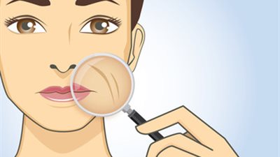 5 خطوات تخلصك من الترهّل حول الفم.. تعرفي عليها