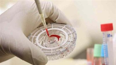 العلماء يكتشفون طريقة لزرع الذكريات من حيوان لآخر