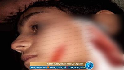 ولية أمر تعتدي على طالب بـ