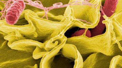 كل ما تود معرفته عن بكتريا السالمونيلا × 10 معلومات