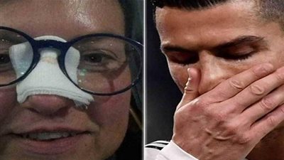 كريستيانو رونالدو يرد على مشجعة كسر أنفها ويتعرض للانتقادات (صور)