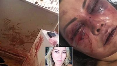 علقة موت.. امرأة تتعرض لهجوم وحشى فى أول لقاء بعد التعارف على الإنترنت