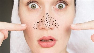 علاجات طبية تقضي على 