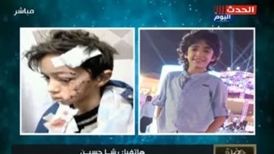 والدة ضحية العقر بمدينتي تفجر مفاجأة جديدة عن الكلاب المتسببه في الحادث