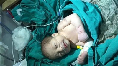 العثور على رضيع مصاب بعضة كلب في شبرا الخيمة 