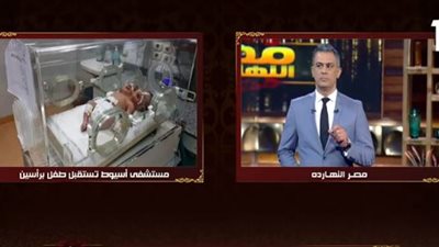 مستشفى أسيوط الجامعي يكشف حقيقة ولادة طفل برأسين (فيديو)