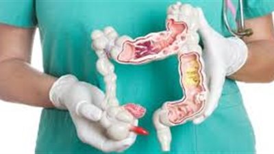 بعد إصابة شريف مدكور بهذا المرض.. كل ما تريد معرفته عن سرطان القولون