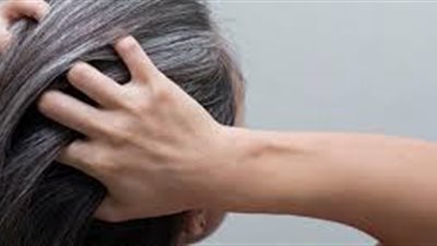 وصفات للتخلص من الشيب المبكر نهائيا.. جربيها قبل الزفاف
