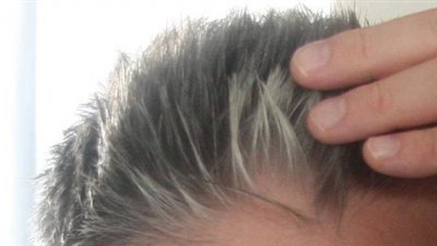 علاج مثالي للتخلص من شيب الشعر بهذه الخلطة المذهلة
