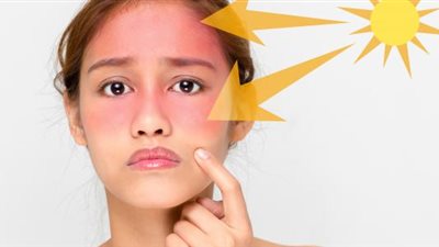 في ظل ارتفاع درجات الحرارة.. طرق لحماية بشرتك من أشعة الشمس
