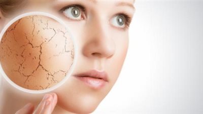 نصائح لحماية بشرتك من الجفاف في الصيف