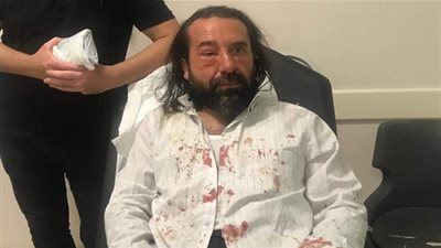 شاهد.. لحظة اعتداء أنصار أردوغان على رجل أعمال معارض (صور+فيديو)