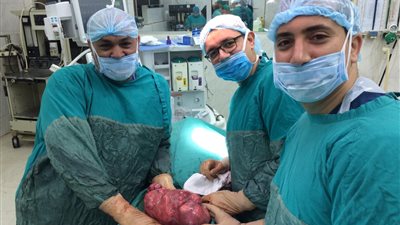 استئصال ورم خبيث يزن حوالي ٤٠ كيلو من سيدة مسنة في الغربية