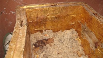 الطيب عباس: لم نكن نتخيل حالة تابوت 