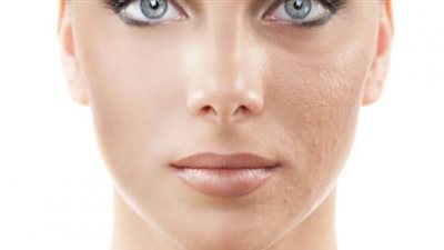 طريقة ترطيب البشرة الجافة في المنزل (فيديو)