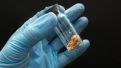 هل توجد بنوك للبويضات في مصر.. أستاذ نساء وتوليد يرد