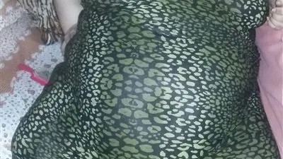 التفاصيل الكاملة لإجراء جراحة قيصرية وتكميم لسيدة تجاوز وزنها 300 كيلوجرام في جامعة المنصورة 