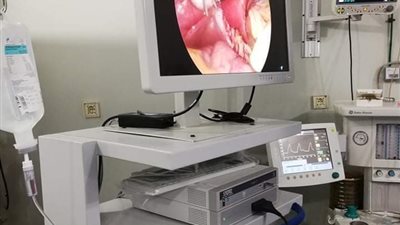 إجراء أول عملية بواسطة جهاز منظار الجراحة بمستشفى السويس (صور)