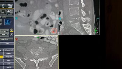 مستشفى أرمنت بالأقصر تنجح في استئصال ورم خبيث لسيدة خمسينية (صور)