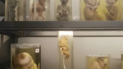 العثور على بقايا 2246 جنينًا في منزل طبيب أمريكي.. تعرف على التفاصيل 