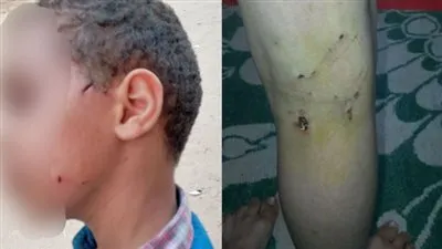 عقر 7 أطفال وحملات وهمية.. تفاصيل قصة 