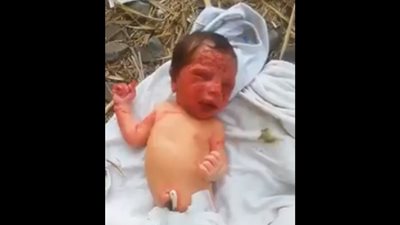 الحشرات تهاجم رضيع وسط الزراعات بالشرقية