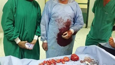 نشرة بنى سويف.. استئصال 20 ورمًا من رحم سيدة وإصابة 9 في حادث 