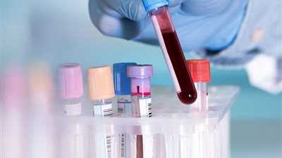 اختبار جديد عن طريق الدم يكشف عن 20 نوع من السرطان بنسبة 99.4%
