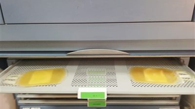 المركز الإقليمي لنقل الدم بالسويس يستلم جهاز حفظ وتخزين الصفائح الدموية (صور)