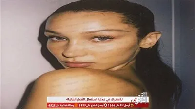 بيلا حديد تستخدم علاج فعّال لبشرة طبيعية متوهجة.. صورة