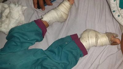 والدة الطفلة المُعنفة على يد والدها بالشرقية تروى تفاصيل الواقعة.. ووكيل التضامن يتدخل (صور) 