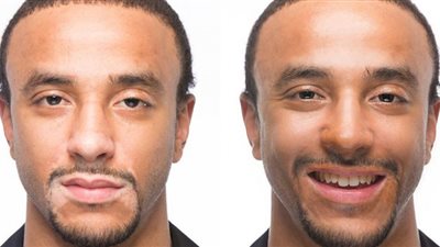 كيف يمكن علاج مرض البهاق؟