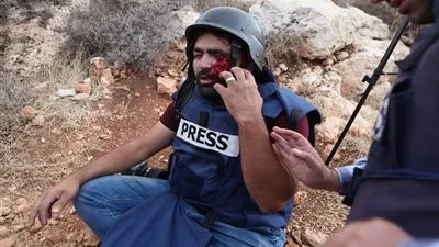 معاذ عمارنة يكشف النظرة الأخيرة قبل فقدان أحد عينيه من سلاح 