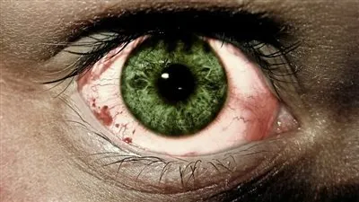 أعراض شائعة خطرة على العين .. اذهب للطبيب فور ظهورها