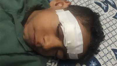 إصابة تلميذ بجرح قطعى فى مشاجرة مع زميله بالسويس 