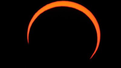 طبيب سعودي ينشر صورة لمريض نظر للشمس أثناء الكسوف: لا يمكن علاجه 