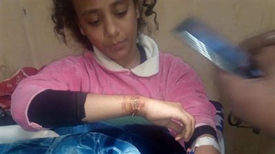 التضامن توجه برعاية طفلة عذبها والدها بالشرقية