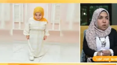 أول عارضة أزياء من قصار القامة تكشف تعرضها للتنمر بالعمل