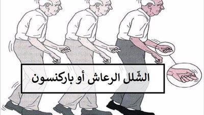 دراسة حديثة: مرض باركنسون 