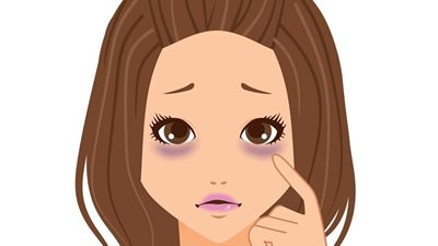 8 أشياء مفاجئة تسبب الهالات السوداء.. تعرفي عليها