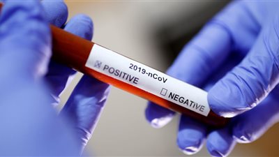 الصين تختبر مضادا لفيروس كورونا