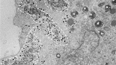 اكتشاف فيروس غامض في البرازيل معلوماته الجينية غير معروفة من قبل